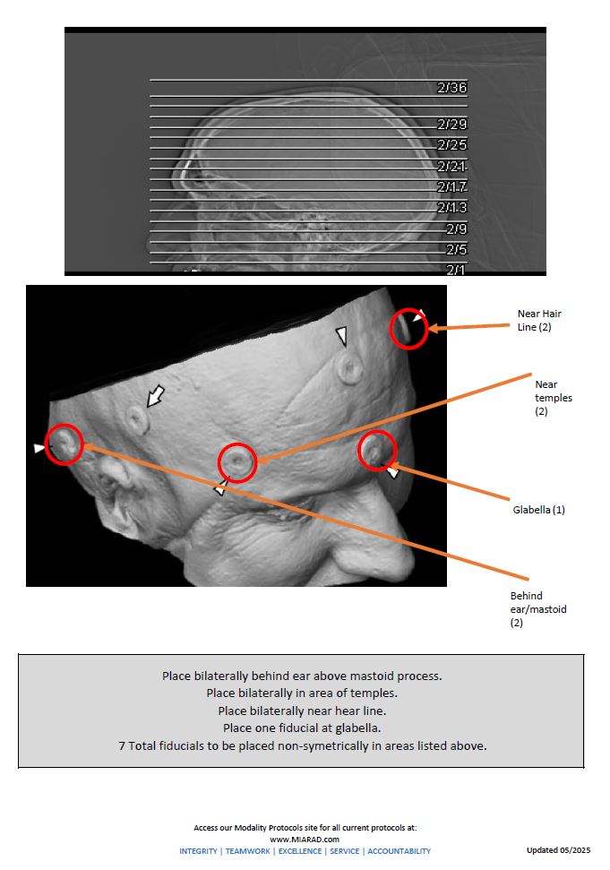 CT Stereo HEAD with Contrast 5-2025.1